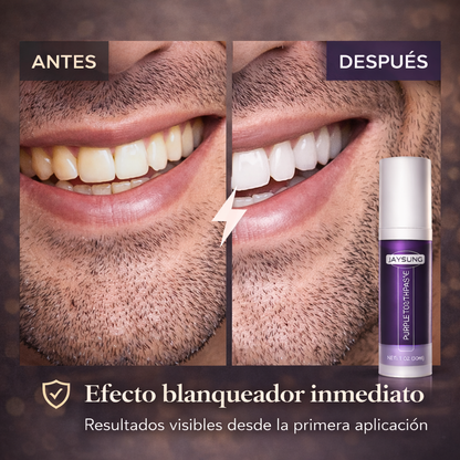 SONRISA V34 BLANQUEADOR INMEDIATO + CORRECCIÓN DEL TONO AMARILLO